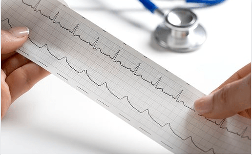 Intro to Basic ECG Course - SIMS